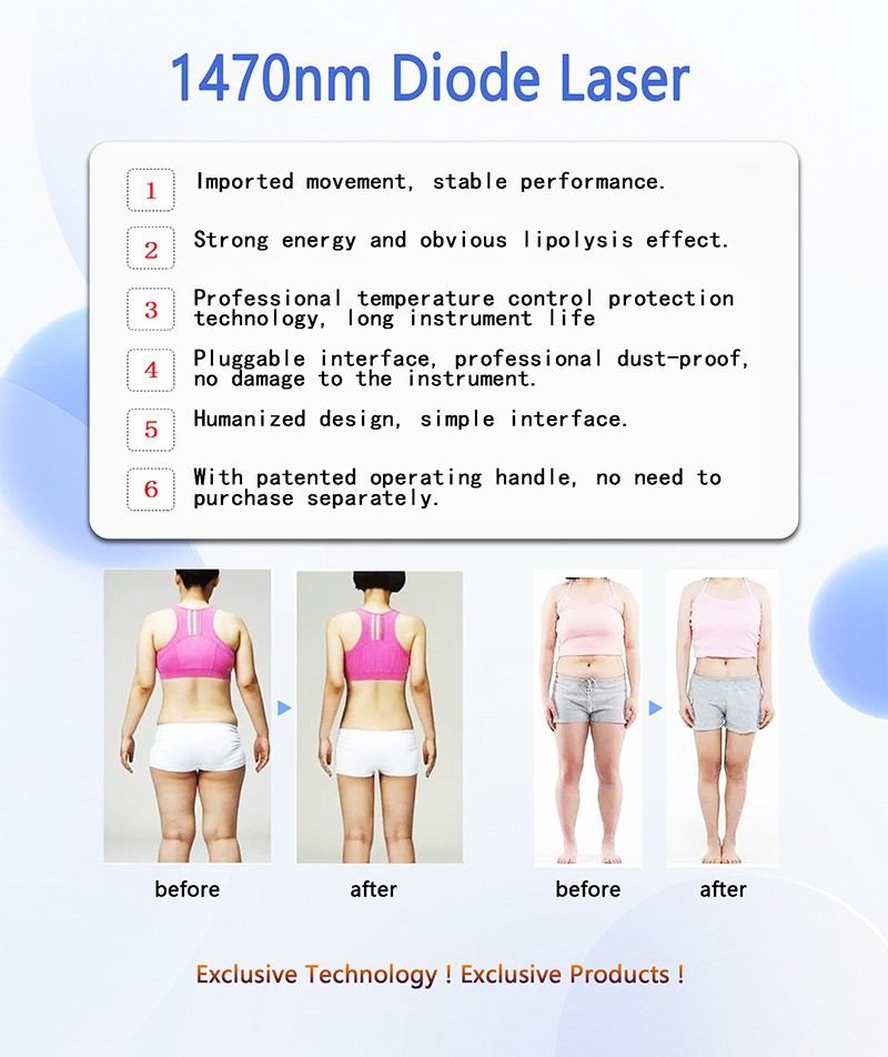 1470nm-lipolysis-diode-laser-machine