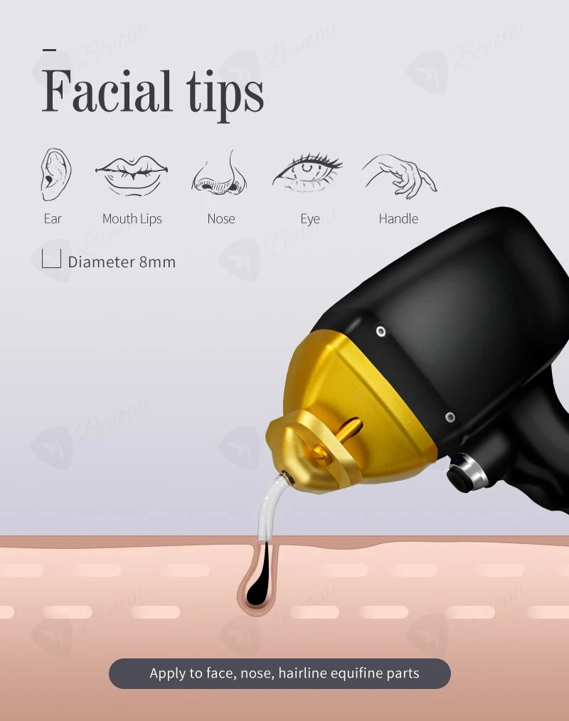 Diode Laser Hair Removal Machine Looking For Dealer