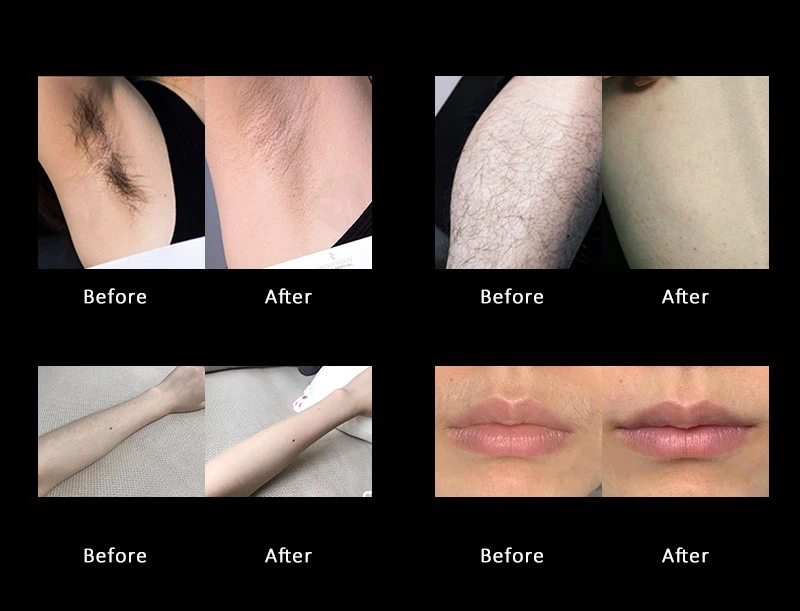 Effect comparisons Effect comparisons